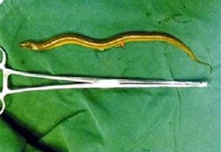 Belut Masuk ke Penis Pria Saat Berendam di Spa Ikan