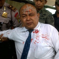 Arifin Nekat Sayat Dahi di Gedung KPK