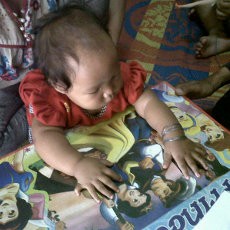 Bila Penyakit Kumat, Kondisi Putri Seperti Sakaratul Maut