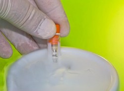 Berencana Telat Nikah? Bekukan Indung Telur Sebelum 35 Tahun