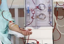 Jarak Cuci Darah 2 Hari Kosong Bisa Berisiko Komplikasi