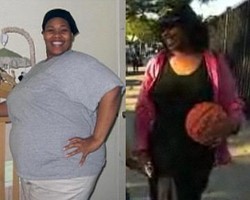 Kecanduan Makan, Berat Badan Wanita Ini Capai 151 Kg