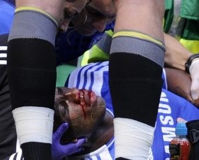 Drogba Merasa Beruntung Masih Hidup