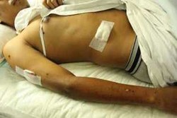 Ini Data 24 Korban Luka Bom Bunuh Diri di Solo