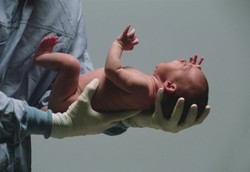 Sejak Ada Jampersal, Jumlah Persalinan di RSUP Soeradji Naik