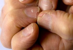 Arti Bintik dan Garis Putih di Kuku