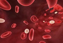 Acute Myelogenous Leukemia, Salah Satu Jenis Kanker Darah