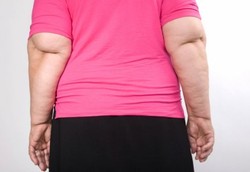 Kelebihan Lemak pada Lansia Membuat Kakinya Jadi Lemah