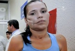 Granat Aktif Bersarang di Wajah Berhasil Dikeluarkan Dokter