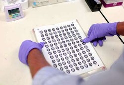 Diagnosis Penyakit Hati Bisa dengan Selembar Kertas Kecil