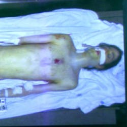 Foto Jenazah Michael Jackson Tanpa Busana Beredar