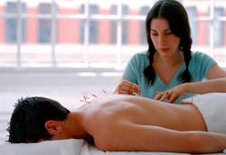 Akupunktur Kurang Efektif Hentikan Kebiasaan Merokok