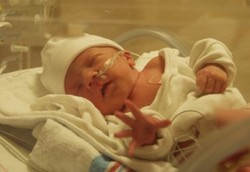 Bayi Prematur Lima Kali Lebih Berisiko Jadi Autis