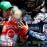 Jari Manis Lorenzo Putus