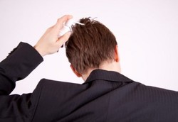 Minoxidil, Obat untuk Atasi Kebotakan