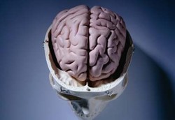 Hematoma Intrakanial, Pecahnya Pembuluh Darah Dalam Otak