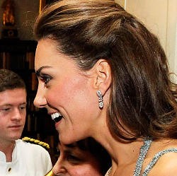 Bekas Luka Misterius di Kepala Kate Middleton