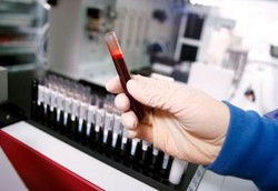 Darah Buatan Siap Diuji 2 Tahun Lagi