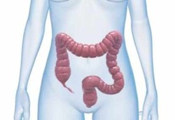 Iskemia Usus, Berkurangnya Suplai Darah ke Sel-sel Usus