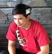 Ikbal Kini Sering Pusing dan Pandangan Matanya Kabur