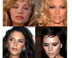 10 Perubahan Drastis Selebriti Setelah Operasi Plastik