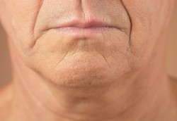 Penyebab Mulut Jadi Kempot