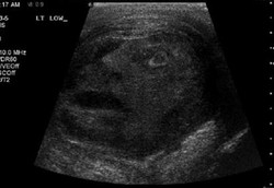 Muncul Penampakan Wajah Manusia Saat Pasien USG Buah Zakar