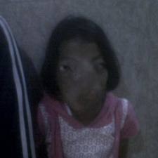 Biaya Operasi Tumor Yani Baru Terkumpul Rp 85 Juta, Kurang Rp 15 Juta