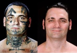 25 Kali Bolak-balik Operasi Laser Demi Hilangkan Tato Nazi