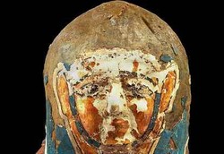 Kanker Prostat Jangkiti Mumi Berusia Ribuan Tahun