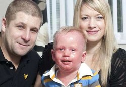 Wajah Seram si Bocah Disangka Karena Orangtua Tak Merawatnya