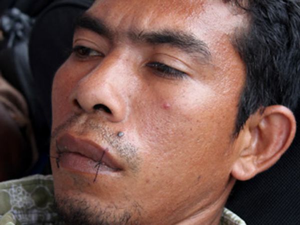 Jahit Mulut Tuntut Menhut