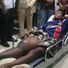 Diduga Alami Kaki Gajah, Warga Tambak Deres Dirawat di RSU Soetomo