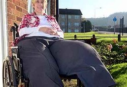 Kaki Terus Membesar Meski Sudah Diamputasi