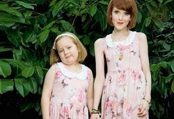 Sangat Kurus, Ibu Anoreksia Bisa Pakai Baju Putrinya Umur 7 Tahun