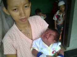 Dokter: Bayi Nangis Darah Kemungkinan Pecah Pembuluh Darah