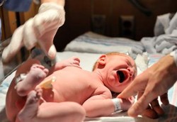 Tunda Potong Tali Pusar 3 Menit Kurangi Risiko Anemia Pada Bayi