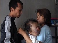 Takut Disalahgunakan, Keluarga Tak Mau Galang Dana untuk Farisa