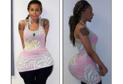 Mau Bahenol Malah Hampir Mati Konyol Gara-gara Implan Semen