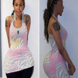 Alamak! Dokter Palsu Perbesar Bokong Wanita Dengan Semen