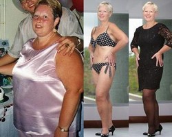 Jual Rumah & Perabotan Demi Operasi Sedot Lemak