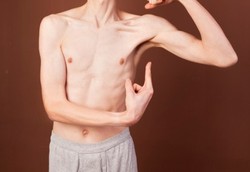 Orang Kurus Berisiko Tinggi Meninggal Setelah Pembedahan