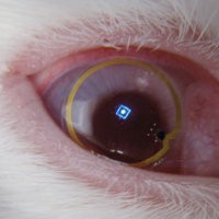 Kontak Lens Canggih Seperti Mata Bionik 