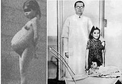 Ibu Termuda Dalam Sejarah, Melahirkan Saat Usia 5 Tahun