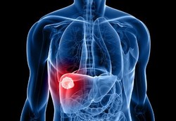 Hepatitis A Hanya Bisa Menyerang Sekali Seumur Hidup