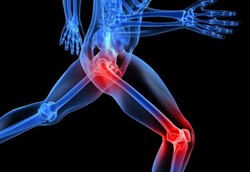 Kista Ganglion, Kista pada Tendon atau Sendi