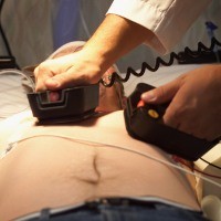 Serangan Jantung Paling Parah Terjadi Saat Dini Hari