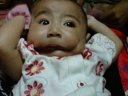  Orangtua Bayi Berkelainan Ini Menunggu Jawaban RSCM