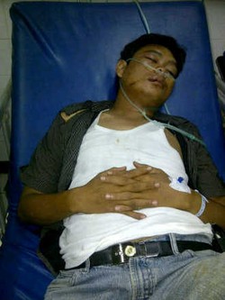 Usai Pesta di Kemang, Reza Digebuki Pria Berbadan Tegap