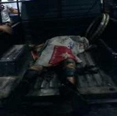 Korban Bakar Diri Mengangguk Saat Ditanya Apakah Dirinya Mahasiswa